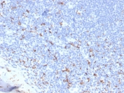 IHC staining of FFPE human tonsil with recombinant CD163 antibody (clone M130/3708R). HIER: boil tissue sections in pH 9 10mM Tris with 1mM EDTA for 20 min and allow to cool before testing.