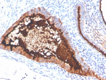 IHC staining of FFPE human ovaria