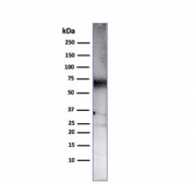 Western blot testing of human Ramos cell lysate with CD86 antibody (clone C86/3711). Expected molecular weight: 38-70 kDa depending on glycosylation level.