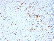 IHC staining of FFPE human spleen with CD33 antibody (clone SIGLEC3/3600). HIER: boil tissue sections in pH 9 10mM Tris with 1mM EDTA for 20 min and allow to cool before testing.
