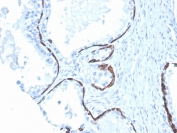 IHC staining of FFPE human prostate with Cytokeratin 5/6 antibody (clone KRT5.6/4866). HIER: boil tissue sections in pH 9 10mM Tris with 1mM EDTA for 20 min and allow to cool before testing.