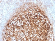 IHC staining of FFPE human tonsil with recombinant CD35 antibody (clone CR1/4382R). HIER: boil tissue sections in pH 9 10mM Tris with 1mM EDTA for 20 min and allow to cool before testing.