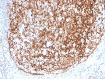 IHC staining of FFPE human tonsil with recombinant CD35 antibody (clone CR1/4382R). HIER: boil tissue sections in pH 9 10mM Tris with 1mM EDTA for 20 min and allow to cool before testing.~