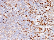 IHC staining of FFPE human tonsil with TIM-3 antibody (clone TIM3/2399). HIER: boil tissue sections in pH 9 10mM Tris with 1mM EDTA for 20 min and allow to cool before testing.
