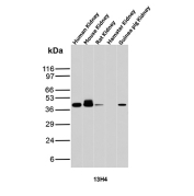 p504S Antibody Kidney Tissue WB. Western blot analysis of human, mouse, rat, hamster, and guinea pig kidney tissue lysates using p504S Antibody clone 13H4 demonstrates a major band at approximately 40-42 kDa in human, mouse, rat, and guinea pig samples, consistent with the predicted molecular weight of Alpha-methylacyl-CoA racemase / AMACR. Variable signal intensity across species may reflect differential epitope conservation or tissue expression levels of this peroxisomal and mitochondrial metabolic enzyme involved in branched-chain fatty acid and bile acid metabolism.