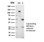 SDS-PAGE analysis of purified, BSA-free Nucleolin antibody (clone NCL/7014R) as confirmation of integrity and purity.