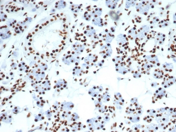 IHC staining of FFPE human salivary gland with Nucleolin antibody (clone NCL/7014R). HIER: boil tissue sections in pH 9 10mM Tris with 1mM EDTA for 20 min and allow to cool before testing.~
