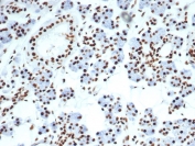 IHC staining of FFPE human salivary gland with Nucleolin antibody (clone NCL/7014R). HIER: boil tissue sections in pH 9 10mM Tris with 1mM EDTA for 20 min and allow to cool before testing.