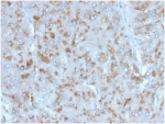 IHC staining of FFPE human adrenal gland tissue with IL15 antibody (clone IL15/4354). HIER: boil tissue sections in pH 9 10mM Tris with 1mM EDTA for 20 min and allow to cool before testing.