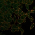 IHC staining of FFPE human thyroid tissue with UBR2 antibody (clone PCRP-UBR2-1D12) at 2ug/ml. HIER: boil tissue sections in pH 9 10mM Tris with 1mM EDTA for 20 min and allow to cool before testing.