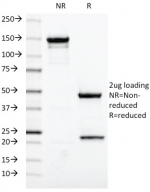 SDS-PAGE analysis of purified, BSA-free Estrogen Receptor alpha antibody (ESR1/420) as confirmation of integrity and purity.