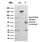 SDS-PAGE analysis of purified, BSA-free IL15 antibody (IL15/4355) as confirmation of integrity and purity.