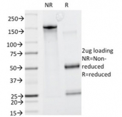 SDS-PAGE analysis of purified, BSA-free HGAL antibody (HGAL/830) as confirmation of integrity and purity.