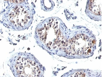 IHC staining of FFPE human testis tissue with HGAL antibody (clone HGAL/830). HIER: boil tissue sections in pH 9 10mM Tris with 1mM EDTA for 20 min and allow to cool before testing.~