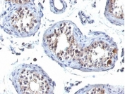 IHC staining of FFPE human testis tissue with HGAL antibody (clone HGAL/830). HIER: boil tissue sections in pH 9 10mM Tris with 1mM EDTA for 20 min and allow to cool before testing.