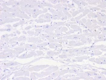 IHC staining of FFPE human heart tissue with Negative control antibody (clone IGG1/453). HIER: boil tissue sections in pH 9 10mM Tris with 1mM EDTA for 20 min and allow to cool before testing.~