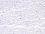 IHC staining of FFPE human heart tissue with Negative control antibody (clone IGG1/453). HIER: boil tissue sections in pH 9 10mM Tris with 1mM EDTA for 20 min and allow to cool before testing.