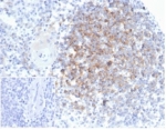IHC staining of FFPE human spleen tissue with Interferon alpha 1 antibody (clone IFNA/6689) at 2ug/ml. Negative control inset: PBS instead of primary antibody to control for secondary binding. HIER: boil tissue sections in pH 9 10mM Tris with 1mM EDTA for 20 min and allow to cool before testing.