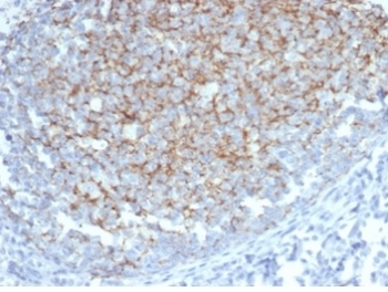 IHC staining of FFPE human tonsil tissue with Interferon alpha 1 antibody (clone IFNA/6689) at 2ug/ml in PBS for 30min RT. HIER: boil tissue sections in pH 9 10mM Tris with 1mM EDTA for 20 min and allow to cool before testing.~