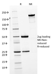 SDS-PAGE analysis of purified, BSA-free IgM Heavy Chain antibody (clone IGHM/1623) as confirmation of integrity and purity.