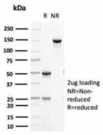 SDS-PAGE analysis of purified, BSA-free CK5 antibody (KRT5/6466) as confirmation of integrity and purity.