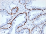 IHC staining of FFPE human prostate tissue with CK5 antibody (clone KRT5/6466). HIER: boil tissue sections in pH 9 10mM Tris with 1mM EDTA for 20 min and allow to cool before testing.