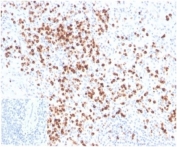 IHC staining of FFPE human spleen tissue with LYZ antibody (clone LYZ/3942). Negative control inset: PBS instead of primary antibody to control for secondary binding. HIER: boil tissue sections in pH 9 10mM Tris with 1mM EDTA for 20 min and allow to cool before testing.