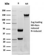 SDS-PAGE analysis of purified, BSA-free LYZ antibody (LYZ/3942) as confirmation of integrity and purity.