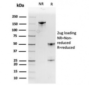 SDS-PAGE analysis of purified, BSA-free Macrophage migration inhibitory factor antibody (MIF/3488) as confirmation of integrity and purity.
