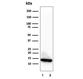 Western blot testing of human 1) LNCaP and 2) PC3 cell lysates using Macrophage migration inhibitory factor antibody (clone MIF/3488). Predicted molecular weight ~13 kDa.