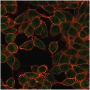 Immunofluorescent staining of PFA-fixed human HeLa cells using MITF antibody (green, clone PCRP-MITF-1D9) and phalloidin (red).