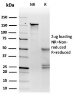 SDS-PAGE analysis of purified, BSA-free MITF antibody (PCRP-MITF-1D9) as confirmation of integrity and purity.
