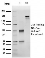 SDS-PAGE analysis of purified, BSA-free NKX3.1 antibody (rNKX3.1/6620) as confirmation of integrity and purity.