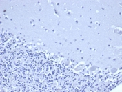 Negative control: IHC staining of FFPE human brain tissue using NKX3.1 antibody (clone rNKX3.1/6620) at 2ug/ml in PBS for 30min RT. HIER: boil tissue sections in pH 9 10mM Tris with 1mM EDTA for 20 min and allow to cool before testing.
