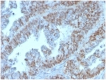 IHC staining of FFPE human colon tissue with PAX2 antibody (clone PAX2/1105). HIER: boil tissue sections in pH 9 10mM Tris with 1mM EDTA for 20 min and allow to cool before testing.