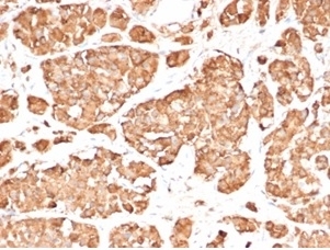IHC staining of FFPE human pituitary gland tissue with recombinant ACTH antibody (clone rCLIP/3814) at 2ug/ml. HIER: boil tissue sections in pH 9 10mM Tris with 1mM EDTA for 20 min and allow to cool before testing.