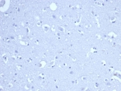 Negative control: IHC staining of FFPE human brain tissue using RRM1 antibody (clone RRM1/4372R) at 2ug/ml in PBS for 30min RT. HIER: boil tissue sections in pH 9 10mM Tris with 1mM EDTA for 20 min and allow to cool before testing.