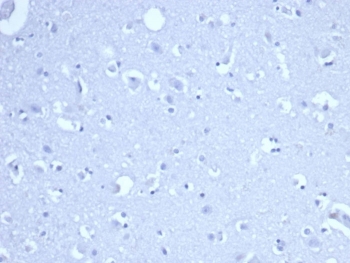 Negative control: IHC staining of FFPE human brain tissue using RRM1 antibody (clone RRM1/4372R) at 2ug/ml in PBS for 30min RT. HIER: boil tissue sections in pH 9 10mM Tris with 1mM EDTA for 20 min and allow to cool before testing.