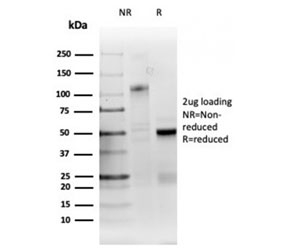 SDS-PAGE analysis of purified, BSA-free RRM1 antibody (RRM1/4372R) as confirmation of integrity and purity.