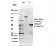 SDS-PAGE analysis of purified, BSA-free RRM1 antibody (RRM1/4372R) as confirmation of integrity and purity.