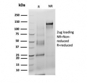 SDS-PAGE analysis of purified, BSA-free S100B antibody (S100B/4140) as confirmation of integrity and purity.