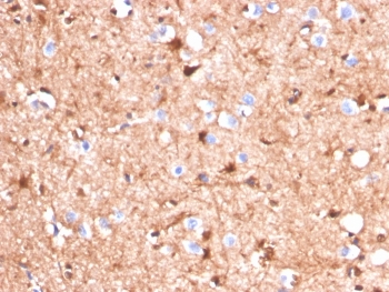 IHC staining of FFPE human cerebellum tissue with S100B antibody (clone S100B/4140). HIER: boil tissue sections in pH 9 10mM Tris with 1mM EDTA for 20 min and allow to cool before testing.