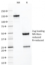 SDS-PAGE analysis of purified, BSA-free SDHB antibody (SDHB/2126) as confirmation of integrity and purity.