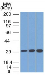 Western blot testing of human 1) 293, 2) Jurkat and 3) HepG2 cell lysate using SDHB antibody (clone SDHB/2126).
