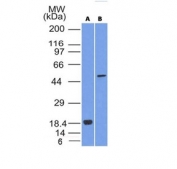Western blot analysis of SOX10 (A) recombinant protein and (B) human A375 cell lysate using SOX10 antibody (clone SOX10/992). Expected molecular weight: 50-58 kDa.