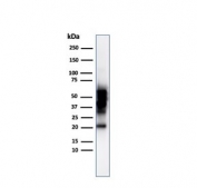 Western blot testing of human COLO-38 cell lysate using SOX10 antibody (clone SOX10/992). Expected molecular weight: 50-58 kDa.