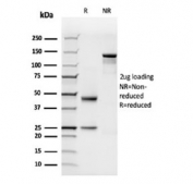 SDS-PAGE analysis of purified, BSA-free Complement C1q B-Chain antibody (C1QB/2962) as confirmation of integrity and purity.