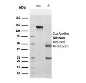 SDS-PAGE analysis of purified, BSA-free Tyrosinase antibody (TYR/3829) as confirmation of integrity and purity.