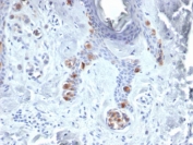 IHC staining of FFPE human skin tissue with Tyrosinase antibody (clone TYR/3829). HIER: boil tissue sections in pH 9 10mM Tris with 1mM EDTA for 20 min and allow to cool before testing.