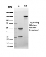 SDS-PAGE analysis of purified, BSA-free von Willebrand Factor antibody (VWF/4106) as confirmation of integrity and purity.